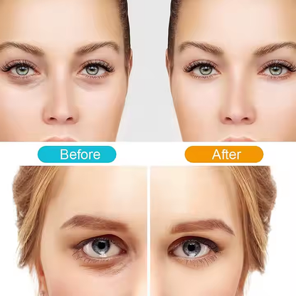 Red Light Therapy Eye Glasses